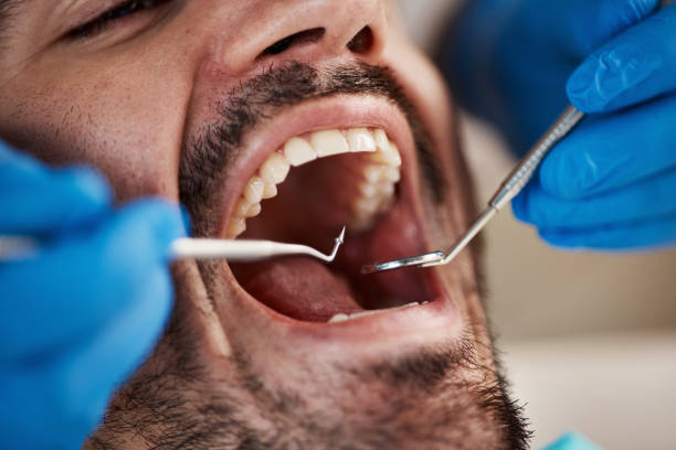 Best Walk-In Emergency Dentist in Prineville, OR